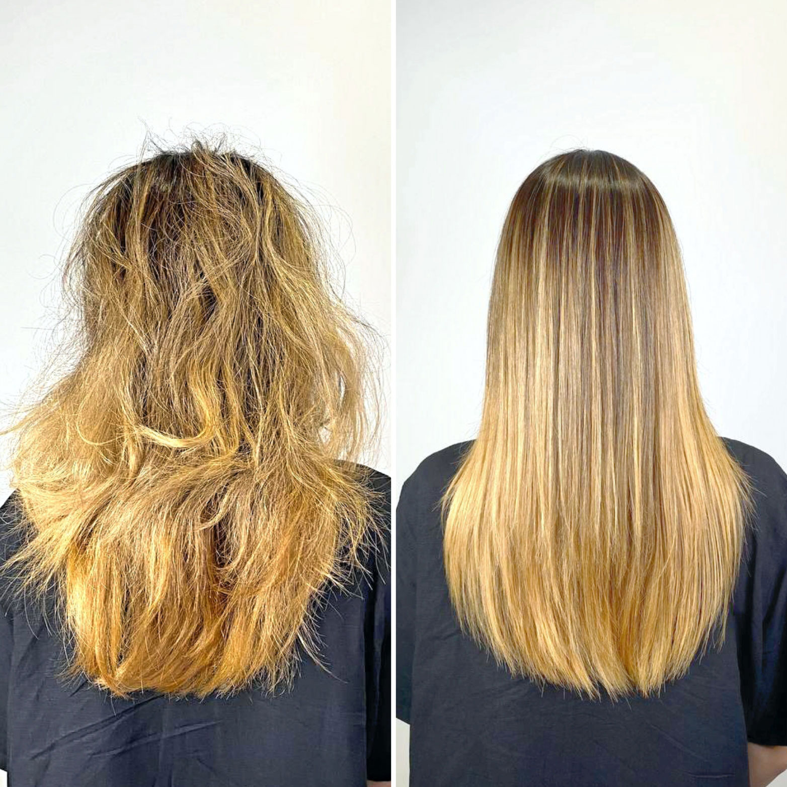1-Hair-Botox-and-Fillers
